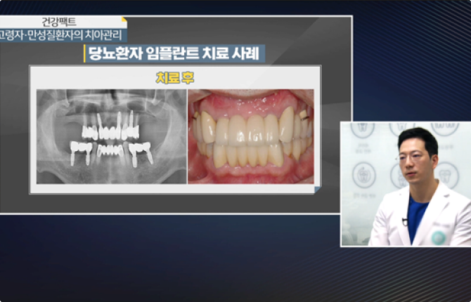 한국경제TV 건강매거진 출연 화면