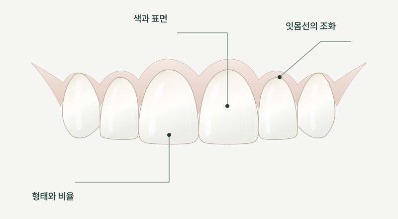 앞니의 형태와 비율, 색과 표면, 잇몸선의 조화를 표시한 설명용 모식도
