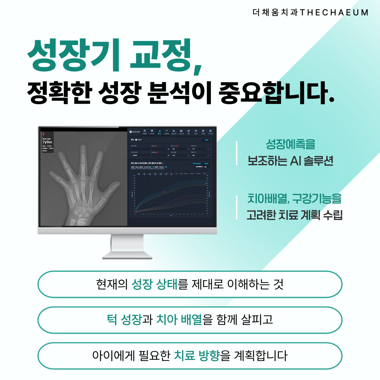 골성숙도와 성장예측을 보조하는 AI 성장 분석 화면