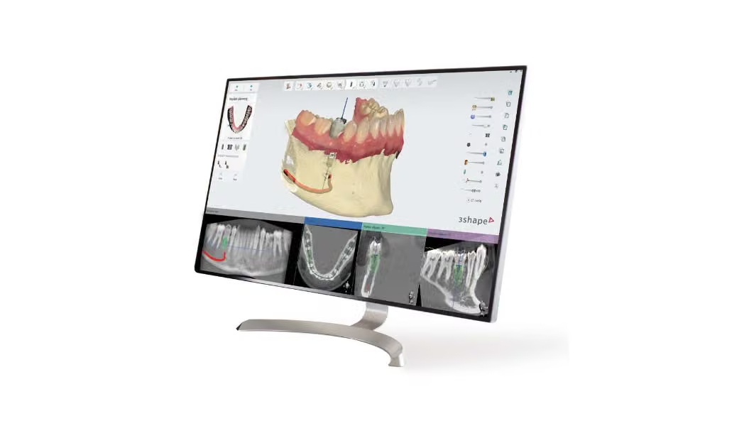 3Shape Implant Studio 제품 이미지